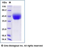 Sino Biological Recombinant Cynomolgus IL-4R Protein (His Tag), HPLC-verified,