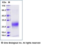 Sino Biological Recombinant Cynomolgus TSLP Protein (His Tag), Quantity: