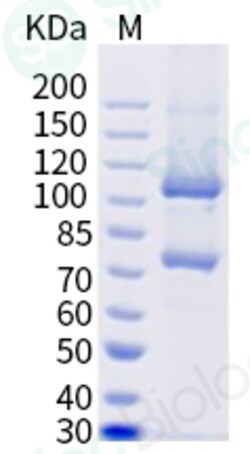 Sino Biological Recombinant Cynomolgus Complement C5 Protein (His Tag)
