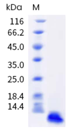 Sino Biological Cynomolgus C5 Protein 1mg, Quantity: Each of 1