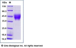 Sino Biological Recombinant Cynomolgus MICA Protein (ECD, His Tag), HPLC-verified,