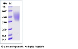 Sino Biological Recombinant Cynomolgus CEACAM-6/CD66c Protein (His Tag),