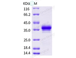 Sino Biological Recombinant Cynomolgus, Rhesus FOLR1 Protein (His Tag),