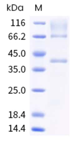 Sino Biological Cynomolgus GPC3 Protein 100ug (Sino Biological), Quantity:
