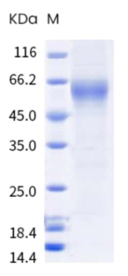 Sino Biological Recombinant Cynomolgus SLC39A6/LIV-1 Protein (His Tag),