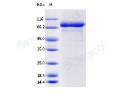 Sino Biological Cynomolgus IL12RB1 Protein (His Tag) 100ug, Quantity: Each