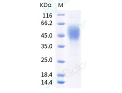 Sino Biological Recombinant Cynomolgus CD200RLa Protein (His Tag), Quantity: