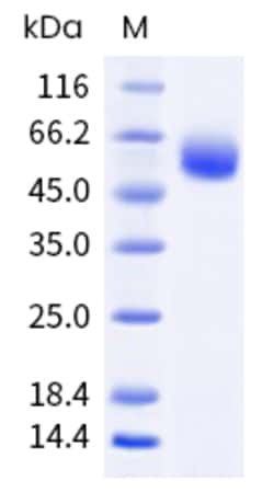 Sino Biological Cynomolgus IL3Ra Protein 1MG (Sino Biological), Quantity: