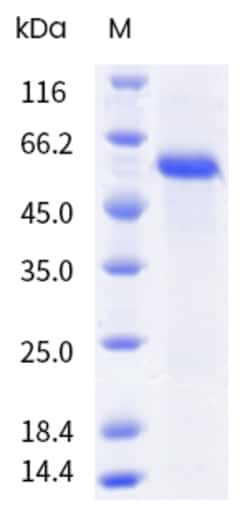 Sino Biological&nbsp;Recombinant Cynomolgus DLL3 Protein (His Tag), HPLC-verified 1