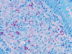 Newcomer Supply AFB (Acid Fast Bacteria), Basic Fuchsin, Ellis & Zabrowarny