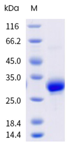 Sino Biological&nbsp;Recombinant Cynomolgus CTHRC1 Protein (His Tag), HPLC-verified 1