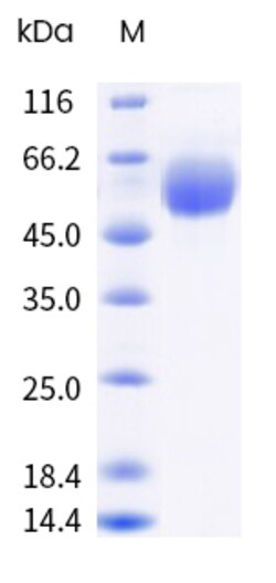 Sino Biological&nbsp;Recombinant Cynomolgus IL-18R beta / IL-18RAP Protein (ECD, His Tag), HPLC-verified 1 mg