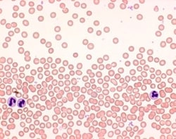 MilliporeSigma Hemacolor™ Rapid Staining of Blood Smear