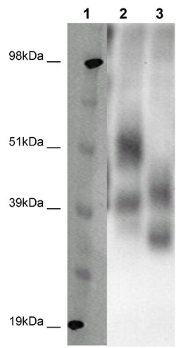 Eurofins Discoverx&nbsp;PathHunter CHO-K1 GPR32 β-Arrestin Orphan GPCR Cell Line, 2 vials. (93-0321C2A)