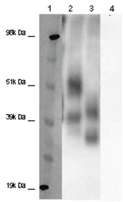 Eurofins Discoverx&nbsp;PathHunter eXpress GPR32 CHO-K1 β-Arrestin Orphan GPCR Assay, 2-Plate Kit. (93-0321E2ACP2M)