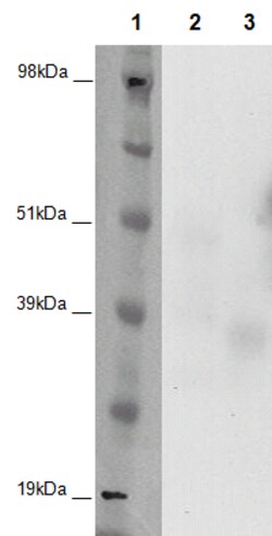 Eurofins Discoverx&nbsp;PathHunter CHO-K1 GPR12 β-Arrestin Orphan GPCR Cell Line, 2 vials. (93-0329C2A)