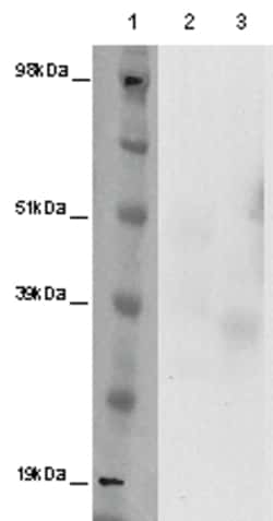 Eurofins Discoverx&nbsp;PathHunter eXpress GPR12 CHO-K1 β-Arrestin Orphan GPCR Assay, 10-Plate Kit. (93-0329E2ACP1L)