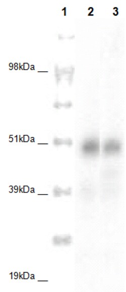 Eurofins Discoverx PathHunter CHO-K1 CCRL2 β-Arrestin Orphan GPCR Cell
