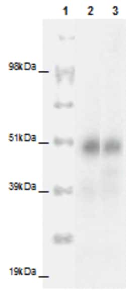 Eurofins Discoverx&nbsp;PathHunter eXpress CCRL2 CHO-K1 β-Arrestin Orphan GPCR Assay, 10-Plate Kit. (93-0333E2ACP1L)