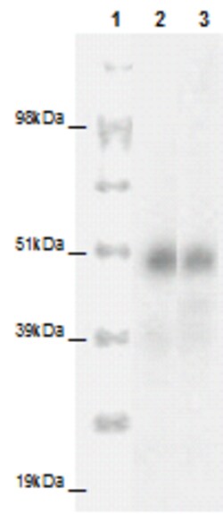 Eurofins Discoverx&nbsp;PathHunter eXpress CCRL2 CHO-K1 β-Arrestin Orphan GPCR Assay, 2-Plate Kit. (93-0333E2ACP1M)