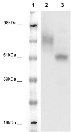 Eurofins Discoverx&nbsp;PathHunter eXpress GPR39 CHO-K1 β-Arrestin Orphan GPCR Assay, 10-Plate Kit. (93-0338E2CP1L)