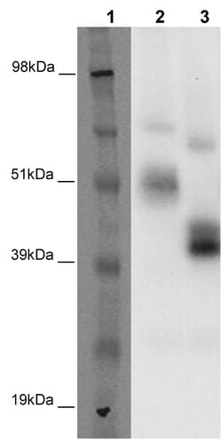 Eurofins Discoverx PathHunter CHO-K1 GPR37 (EDNRBL) β-Arrestin Orphan GPCR