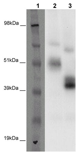 Eurofins Discoverx&nbsp;PathHunter eXpress GPR37 CHO-K1 β-Arrestin Orphan GPCR Assay, 2-Plate Kit. (93-0339E2ACP1M)