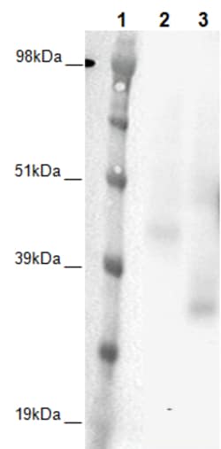 Eurofins Discoverx&nbsp;PathHunter CHO-K1 GHSR1b β-Arrestin Orphan GPCR Cell Line, 2 vials. (93-0354C2A)