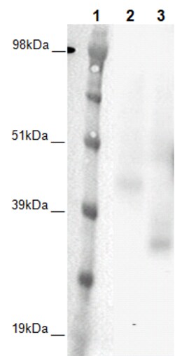 Eurofins Discoverx&nbsp;PathHunter eXpress GHSR1b CHO-K1 β-Arrestin Orphan GPCR Assay, 10-Plate Kit. (93-0354E2ACP1L)