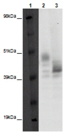 Eurofins Discoverx&nbsp;PathHunter eXpress GPR88 CHO-K1 β-Arrestin Orphan GPCR Assay, 10-Plate Kit. (93-0357E2ACP1L)