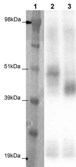 Eurofins Discoverx&nbsp;PathHunter CHO-K1 GPR137 (TM7SF1) β-Arrestin Orphan GPCR Cell Line, 2 vials. (93-0361C2A)