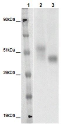 Eurofins Discoverx&nbsp;PathHunter eXpress GPR143 CHO-K1 β-Arrestin Orphan GPCR Assay, 2-Plate Kit. (93-0362E2ACP1M)