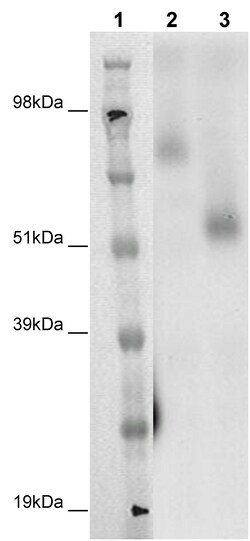 Eurofins Discoverx&nbsp;PathHunter eXpress GPR75 CHO-K1 β-Arrestin Orphan GPCR Assay, 10-Plate Kit. (93-0363E2ACP1L)