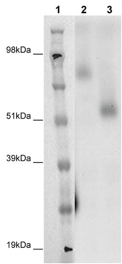Eurofins Discoverx&nbsp;PathHunter eXpress GPR75 CHO-K1 β-Arrestin Orphan GPCR Assay, 2-Plate Kit. (93-0363E2ACP1M)