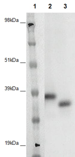 Eurofins Discoverx PathHunter CHO-K1 GPR148 β-Arrestin Orphan GPCR Cell