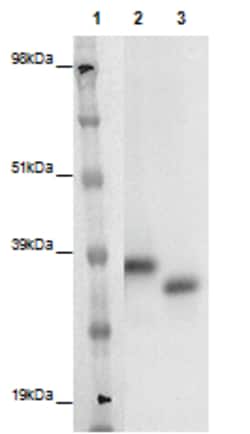 Eurofins Discoverx&nbsp;PathHunter eXpress GPR148 CHO-K1 β-Arrestin Orphan GPCR Assay, 10-Plate Kit. (93-0364E2ACP1L)