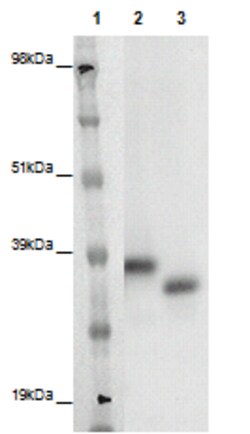Eurofins Discoverx&nbsp;PathHunter eXpress GPR148 CHO-K1 β-Arrestin Orphan GPCR Assay, 2-Plate Kit. (93-0364E2ACP1M)