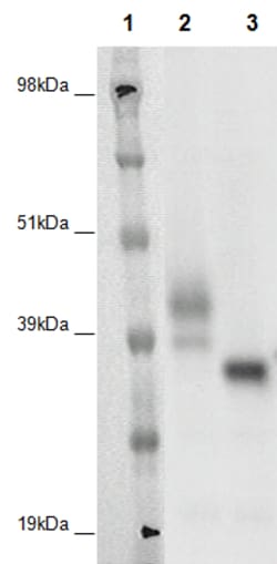 Eurofins Discoverx PathHunter CHO-K1 GPR146 β-Arrestin Orphan GPCR Cell Line, 2 vials. (93-0365C2A)
