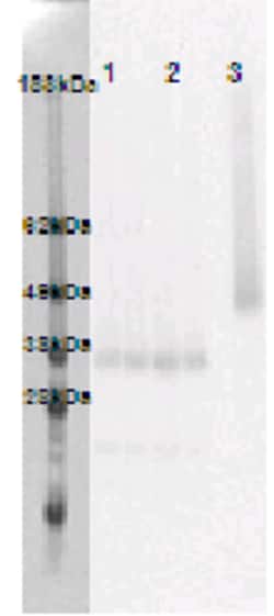 Eurofins Discoverx&nbsp;PathHunter eXpress GPR146 CHO-K1 β-Arrestin Orphan GPCR Assay, 10-Plate Kit. (93-0365E2ACP1L)