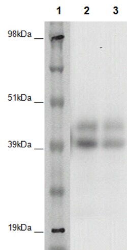 Eurofins Discoverx&nbsp;PathHunter CHO-K1 GPR25 β-Arrestin Orphan GPCR Cell Line, 2 vials. (93-0368C2A)