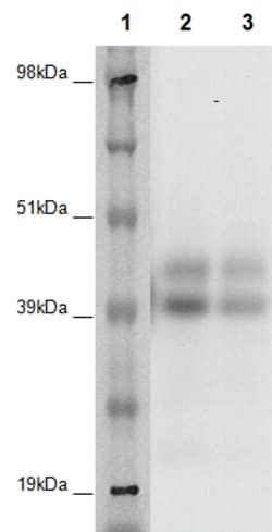 Eurofins Discoverx&nbsp;PathHunter eXpress GPR25 CHO-K1 β-Arrestin Orphan GPCR Assay, 10-Plate Kit. (93-0368E2ACP2L)
