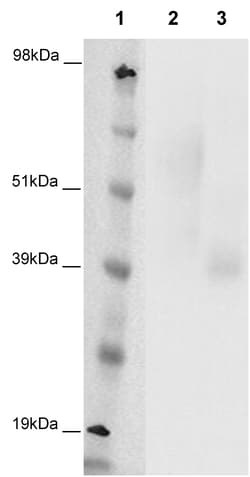 Eurofins Discoverx&nbsp;PathHunter eXpress GPR4 CHO-K1 β-Arrestin Orphan GPCR Assay, 10-Plate Kit. (93-0369E2ACP1L)