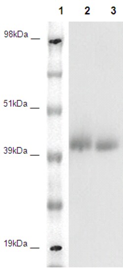 Eurofins Discoverx&nbsp;PathHunter CHO-K1 GPR78 β-Arrestin Orphan GPCR Cell Line, 2 vials. (93-0370C2A)