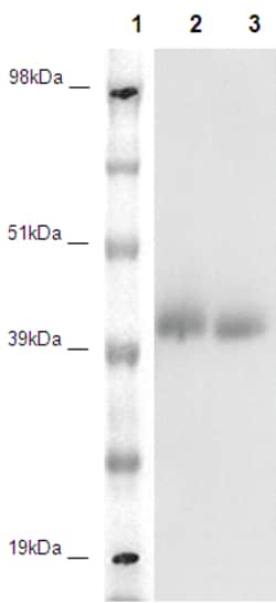 Eurofins Discoverx&nbsp;PathHunter eXpress GPR78 CHO-K1 β-Arrestin Orphan GPCR Assay, 2-Plate Kit. (93-0370E2ACP1M)