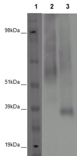 Eurofins Discoverx PathHunter U2OS GPR52 β-Arrestin Orphan GPCR Cell Line, 2 vials. (93-0371C3)