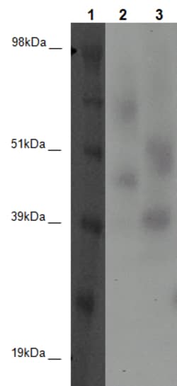 Eurofins Discoverx&nbsp;PathHunter CHO-K1 GPR30 β-Arrestin Orphan GPCR Cell Line, 2 vials. (93-0373C2A)