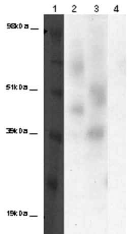 Eurofins Discoverx&nbsp;PathHunter eXpress GPR30 CHO-K1 β-Arrestin Orphan GPCR Assay, 2-Plate Kit. (93-0373E2ACP2M)