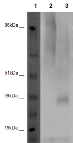 Eurofins Discoverx&nbsp;PathHunter HEK 293 GPR45 β-Arrestin Orphan GPCR Cell Line, 2 vials. (93-0374C1A)