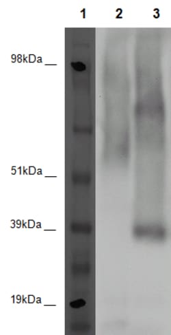 Eurofins Discoverx&nbsp;PathHunter eXpress GPR45 CHO-K1 β-Arrestin Orphan GPCR Assay, 10-Plate Kit. (93-0374E2ACP1L)