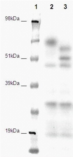 Eurofins Discoverx&nbsp;PathHunter HEK 293 GPR150 β-Arrestin Orphan GPCR Cell Line, 2 vials. (93-0375C1A)